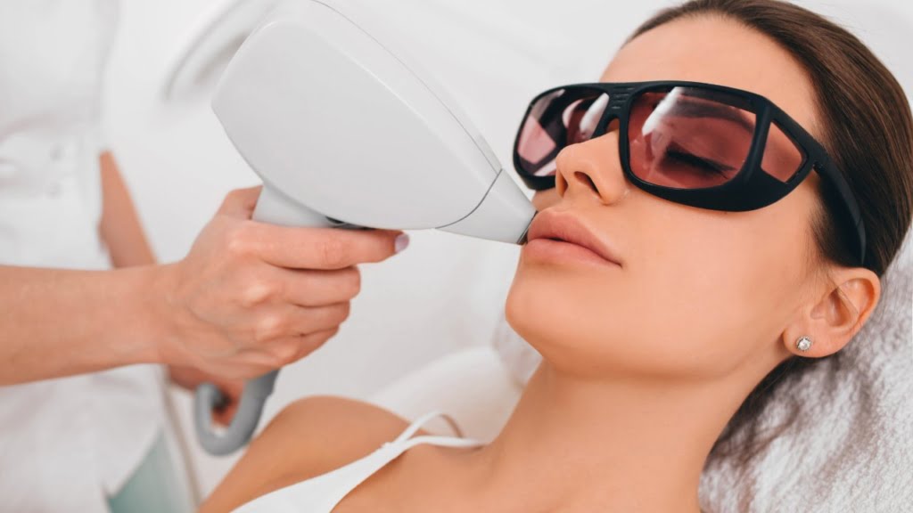 Laser Bibir: Manfaat, Efek Samping, dan Harga di Klinik Kecantikan