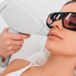 Laser Bibir: Manfaat, Efek Samping, dan Harga di Klinik Kecantikan