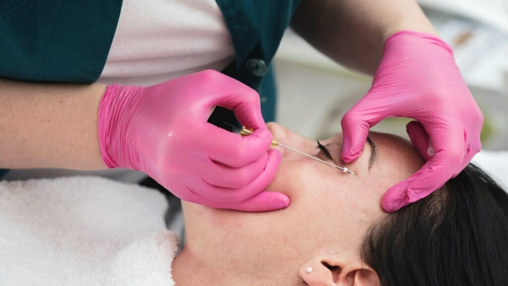 Mengenal Treatment PRP untuk Bopeng dan Kisaran Harganya