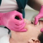 Mengenal Treatment PRP untuk Bopeng dan Kisaran Harganya