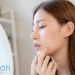 Masker Wardah Untuk Komedo yang Paling Ampuh
