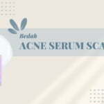 5 Ciri-ciri Tidak Cocok Memakai Serum Scarlett Acne