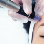Daftar Harga Treatment Dermapen di Klinik Kecantikan Ternama