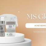 Perbedaan Skincare MS Glow Acne dan MS Glow Whitening