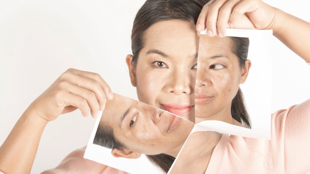 10 Ciri-Ciri Skincare Tidak Cocok di Wajah, Segera Hentikan Pemakaian!