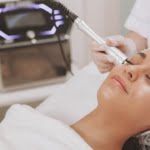 Treatment Menghilangkan Bekas Jerawat