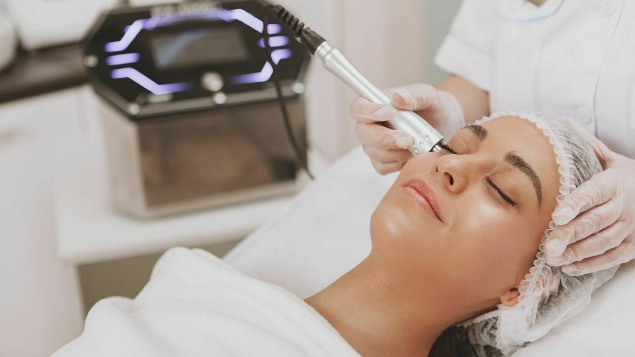 Treatment Menghilangkan Bekas Jerawat