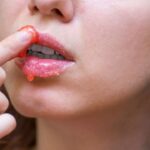 Mengenal Eksfoliasi Bibir, Manfaat, dan Produk Rekomendasinya
