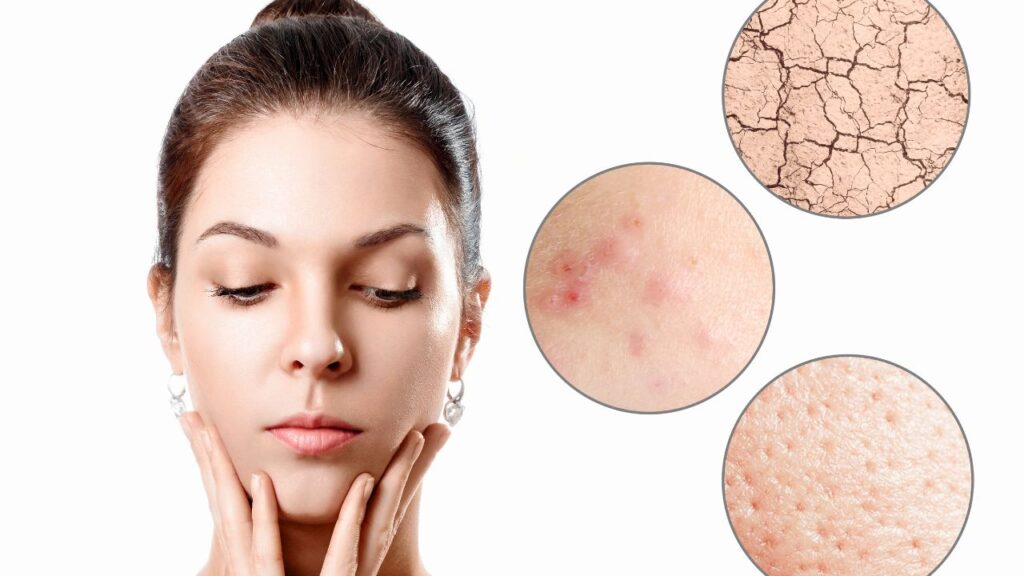 Yuk, Ketahui Ciri-Ciri Kulit Kering Beserta Penyebabnya Ini