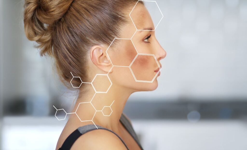 Melasma Treatment : Pengertian, Manfaat, dan Prosesnya