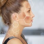 Melasma Treatment : Pengertian, Manfaat, dan Prosesnya