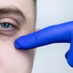 7 Tips untuk Menghindari Mata Panda Selama Berpuasa