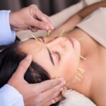 7 Manfaat Akupuntur untuk Kecantikan, Bisa Bikin Awet Muda!