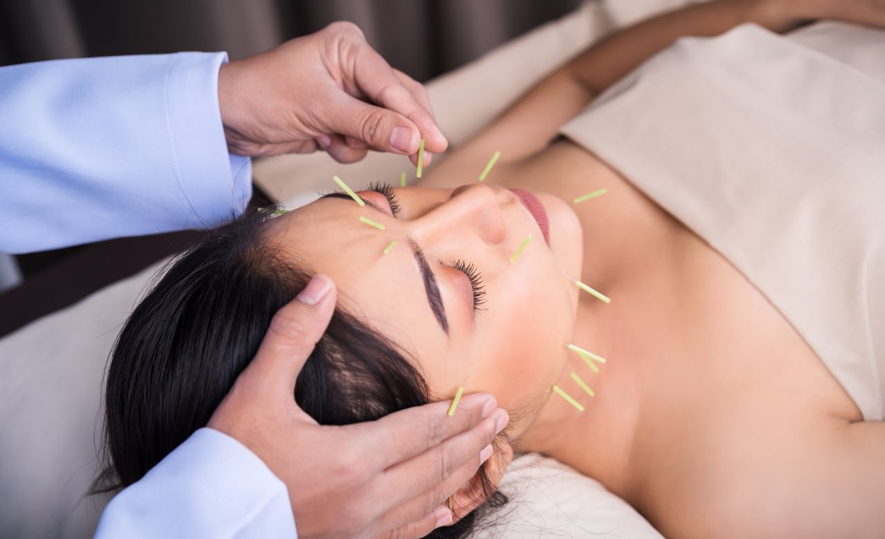 7 Manfaat Akupuntur untuk Kecantikan, Bisa Bikin Awet Muda!
