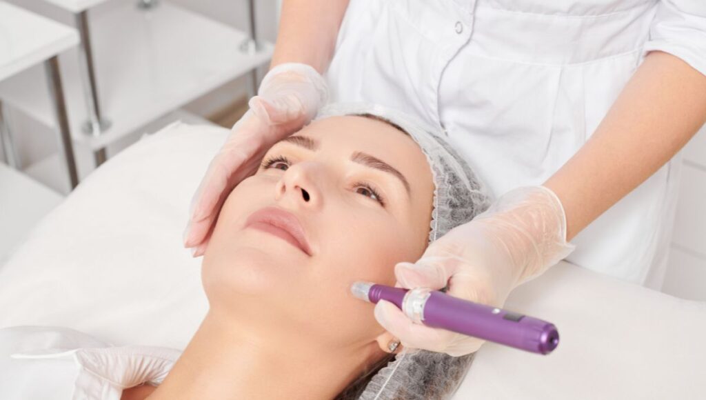 Microneedling, Perawatan Kulit yang Dapat Tingkatkan Kolagen