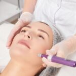 Microneedling, Perawatan Kulit yang Dapat Tingkatkan Kolagen